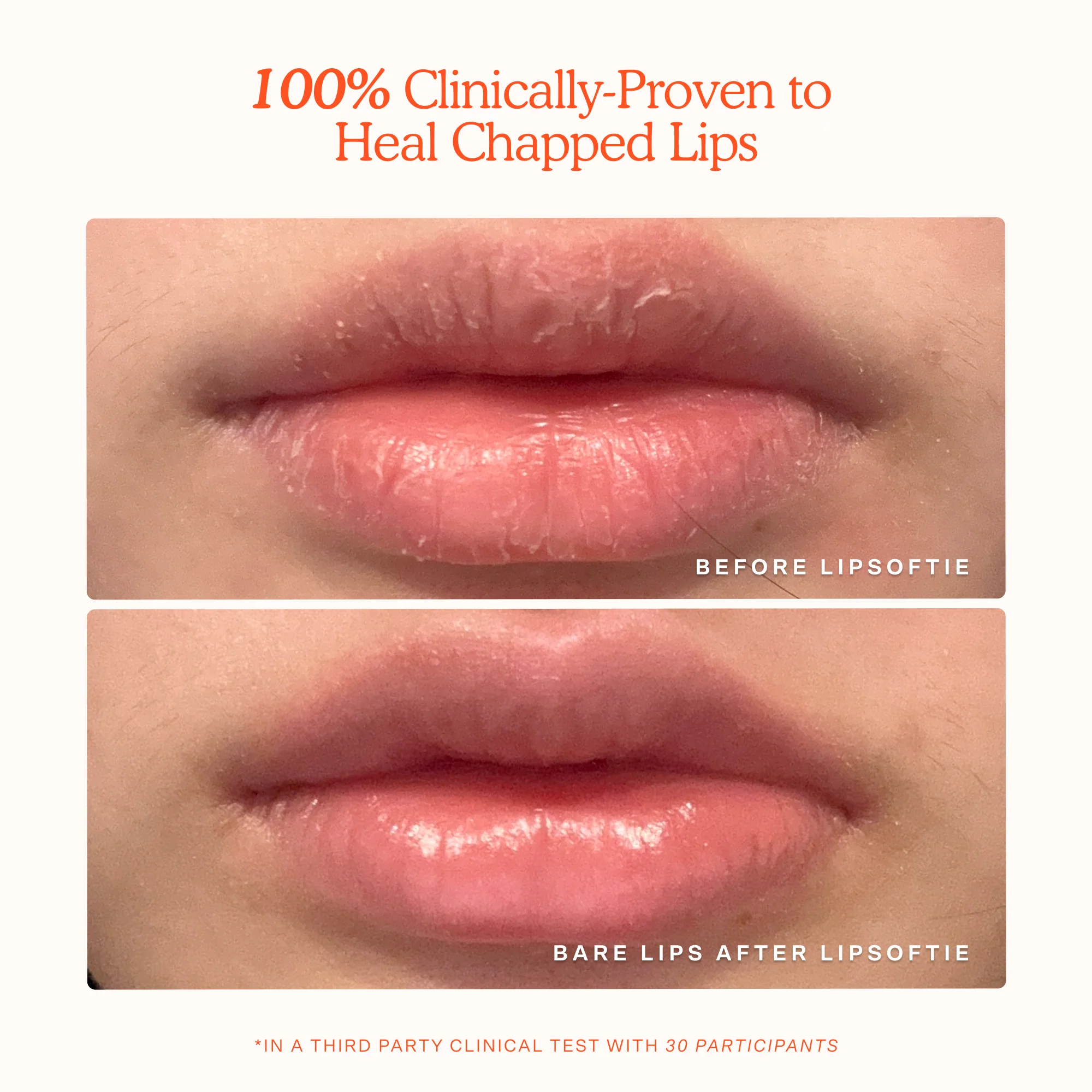 LipSoftie® Lip Treatment - Image 4