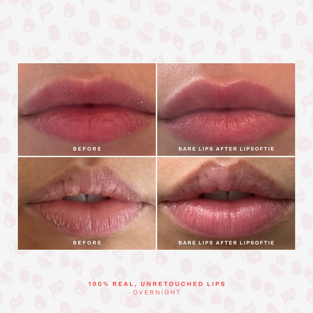 LipSoftie® Lip Treatment - Image 54
