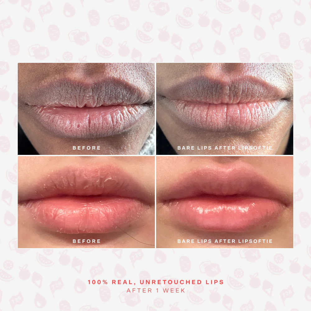 LipSoftie® Lip Treatment - Image 55