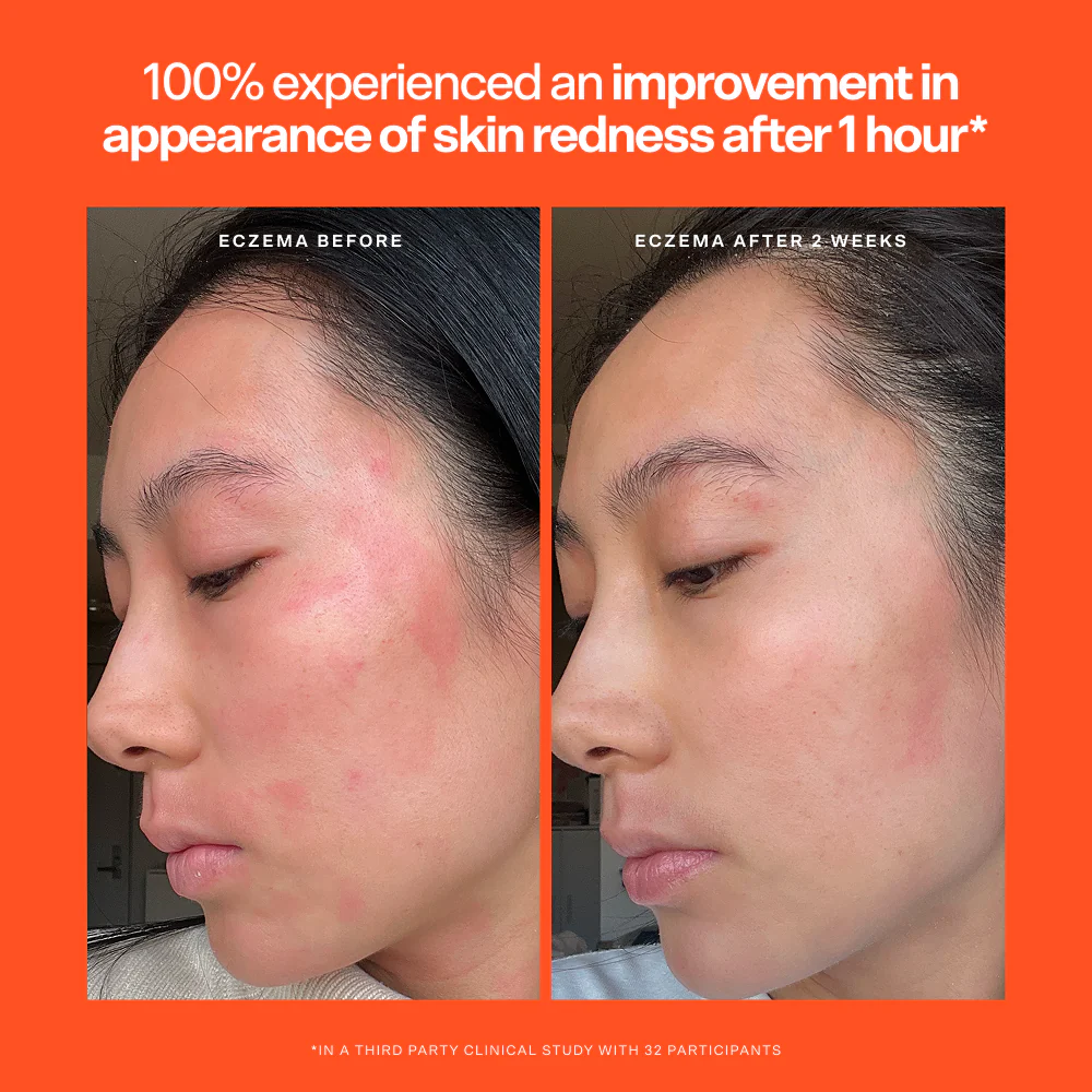 SOS Rescue Serum - Image 5