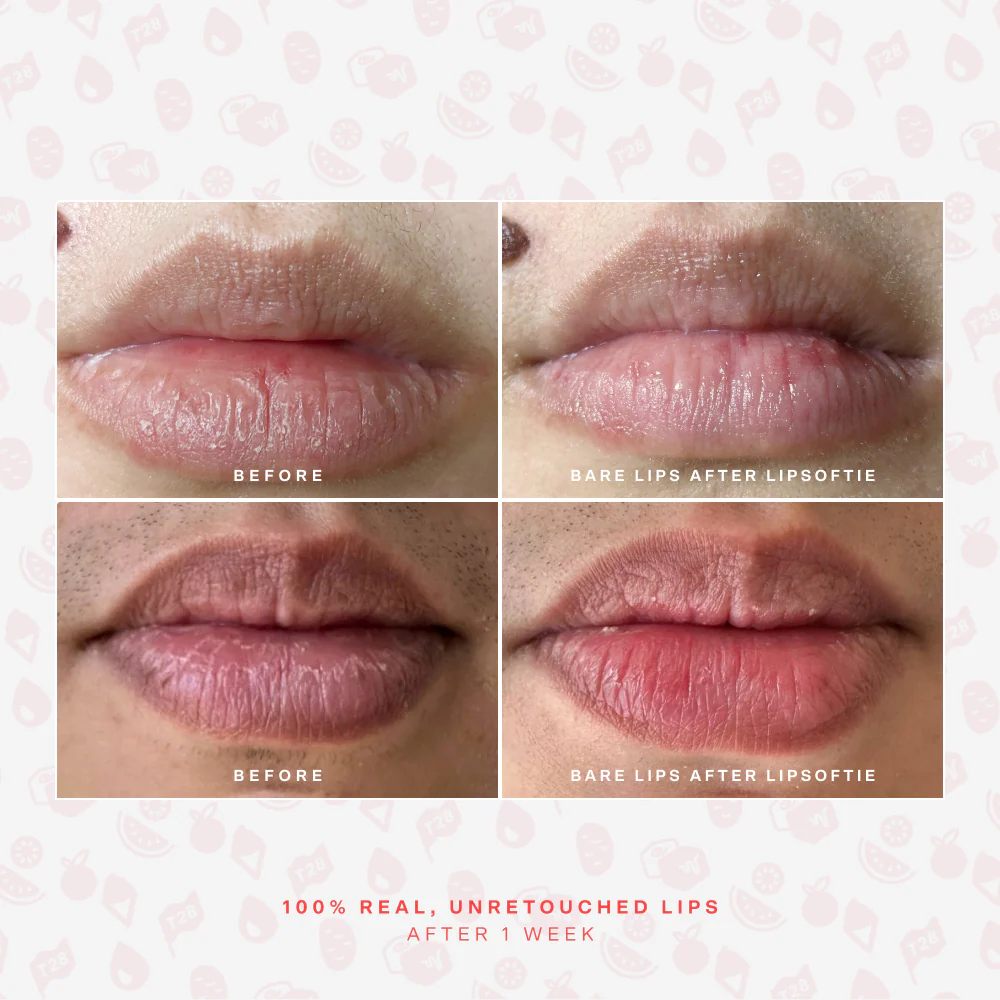 SOS LipSoftie® Lip Treatment - Image 7
