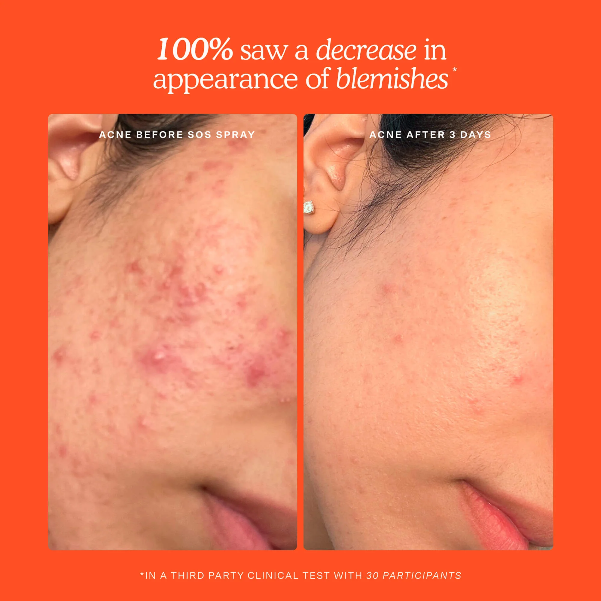 SOS 3-Step Skincare Set - Image 5
