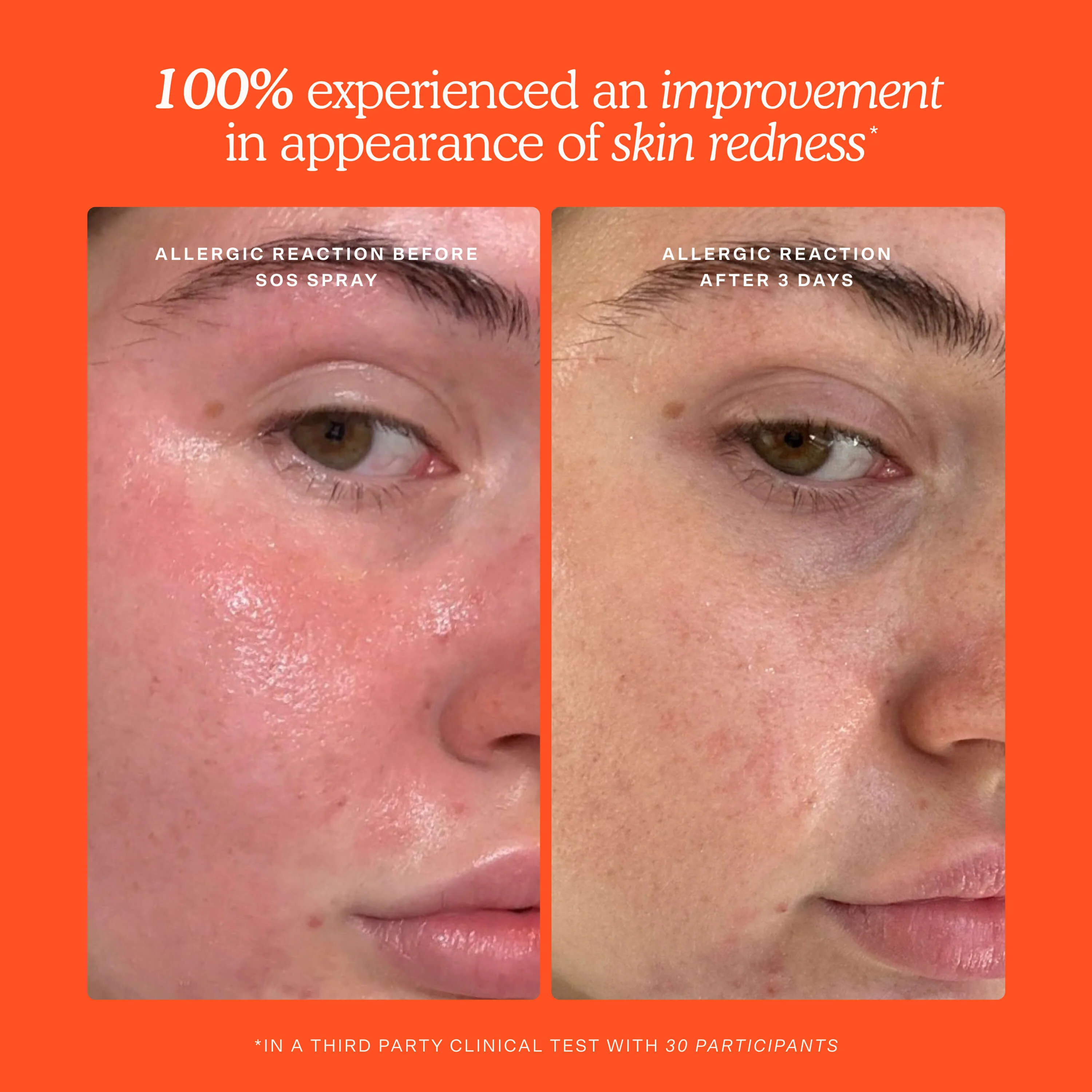 SOS 3-Step Skincare Set - Image 6