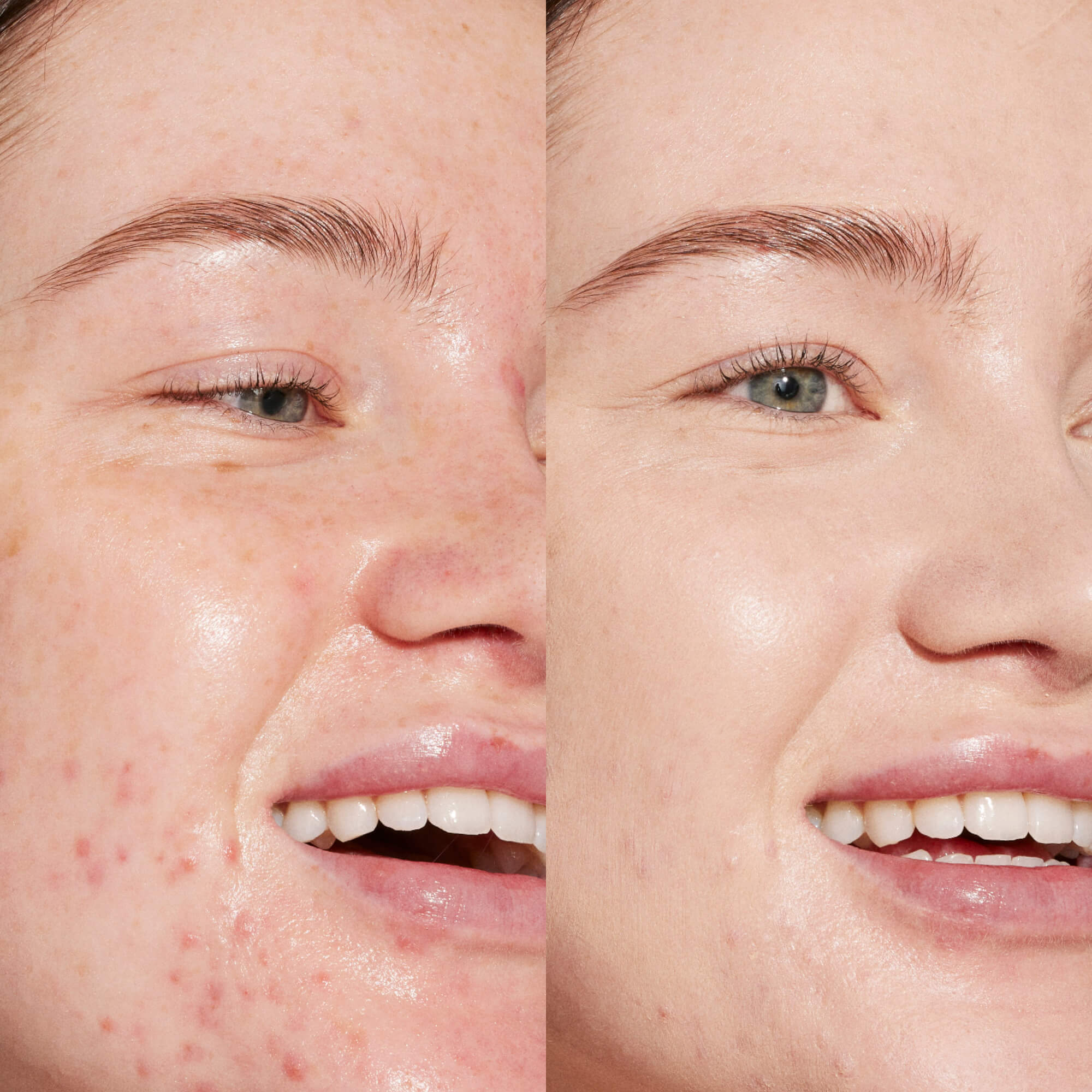 Swipe Serum Concealer® - Image 2